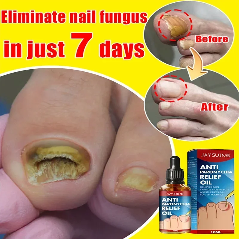 

【Last Day 50% OFF】7-day Nail Growth and Strengthening Serum