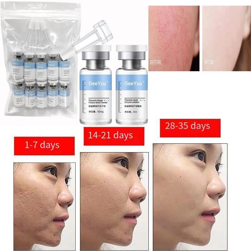 

Oligopeptide Placenta Serum Moisturizing Hydrating Face Serum Acne removal Anti-wrinkle Anti-aging Whitening Skin Care