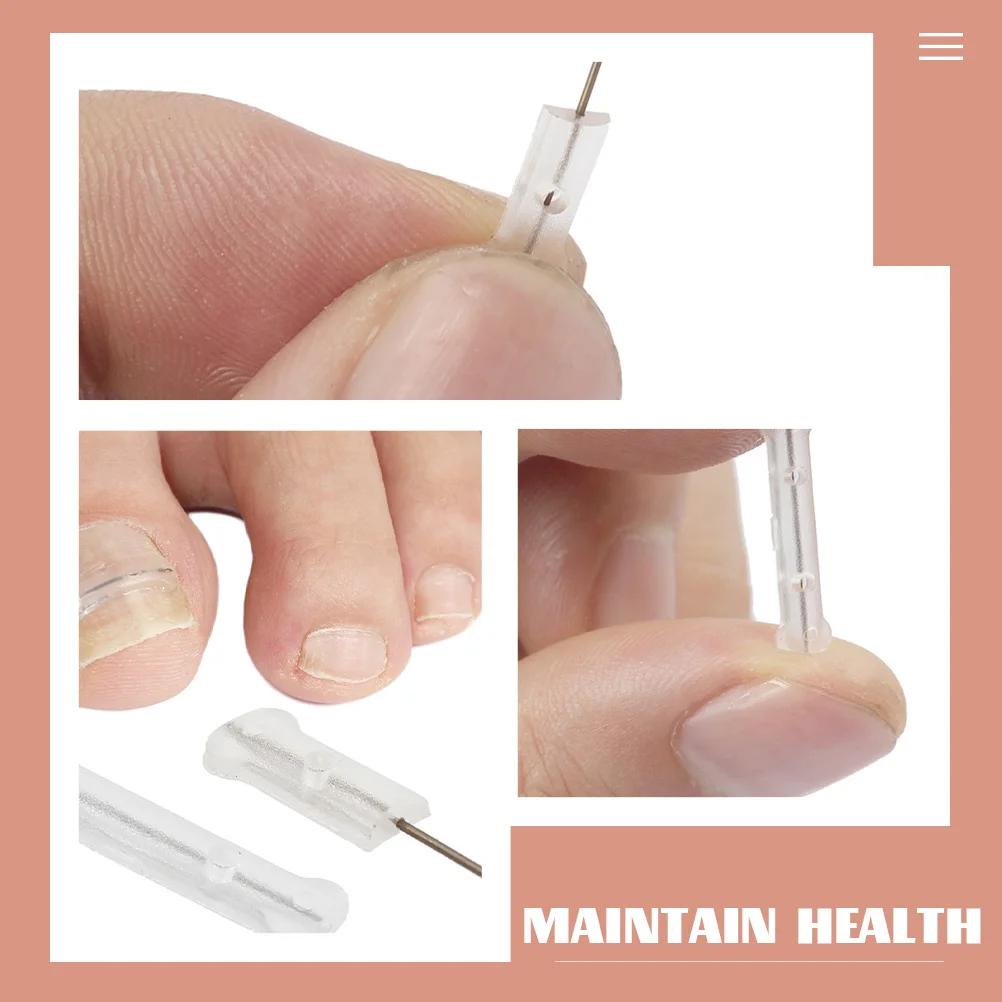

Adjustable Toenail Corrector Silicone Ingrown Nail Repair Tool Reusable Nail Correction Wire For Toe Use Household