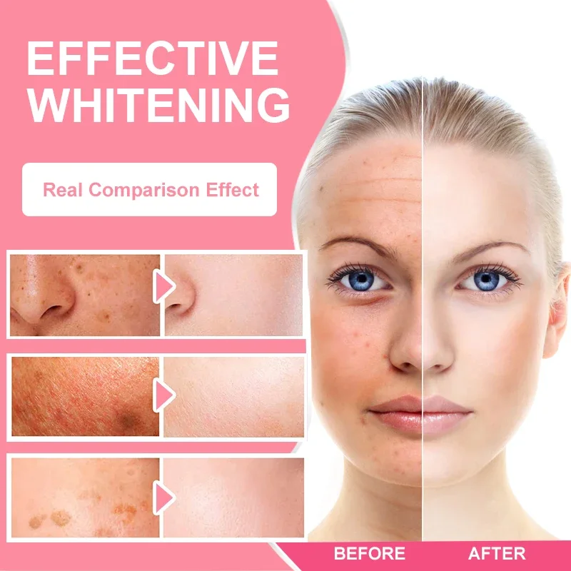 Skin Lightening Supplement, with Grape Seed & Procyanidins, Even Tone, Reduce Pigmentation & Glow