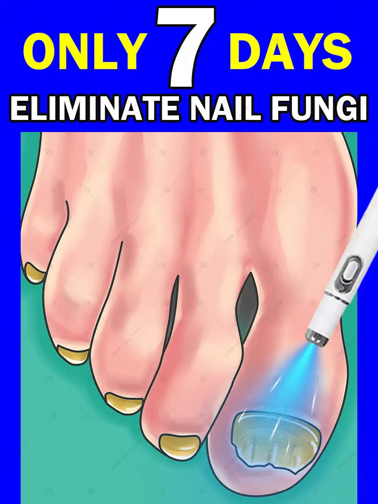 บอกลาเล็บเชื้อรา การเปลี่ยนเล็บที่ไม่เจ็บปวด