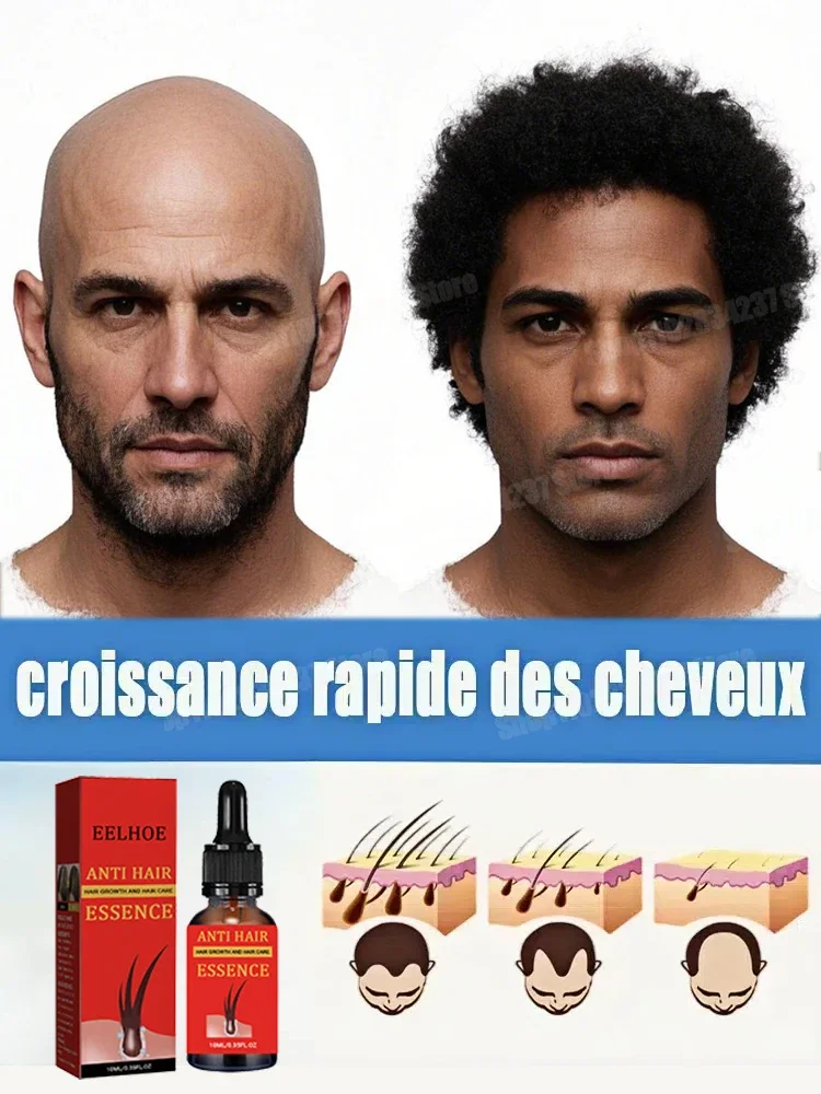 

Hair Loss Care Oil for Hair Growth, Hair Care Essential Oils for Men and Women