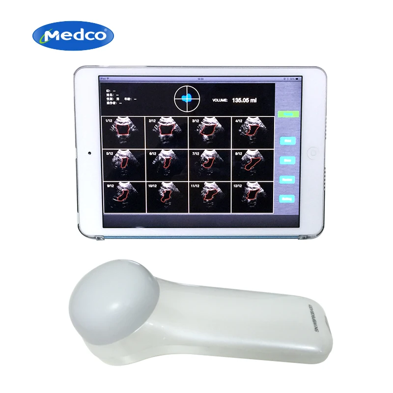 Portable waterproof 4D wireless bladder scanner for Urology Department