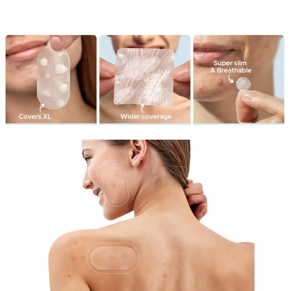 116/364/435 قطعة سعة كبيرة حب الشباب التصحيح غرواني مائي الساليسيليك شفافة حب الشباب التصحيح غير مرئية حب الشباب إزالة ملصق الوجه الجمال