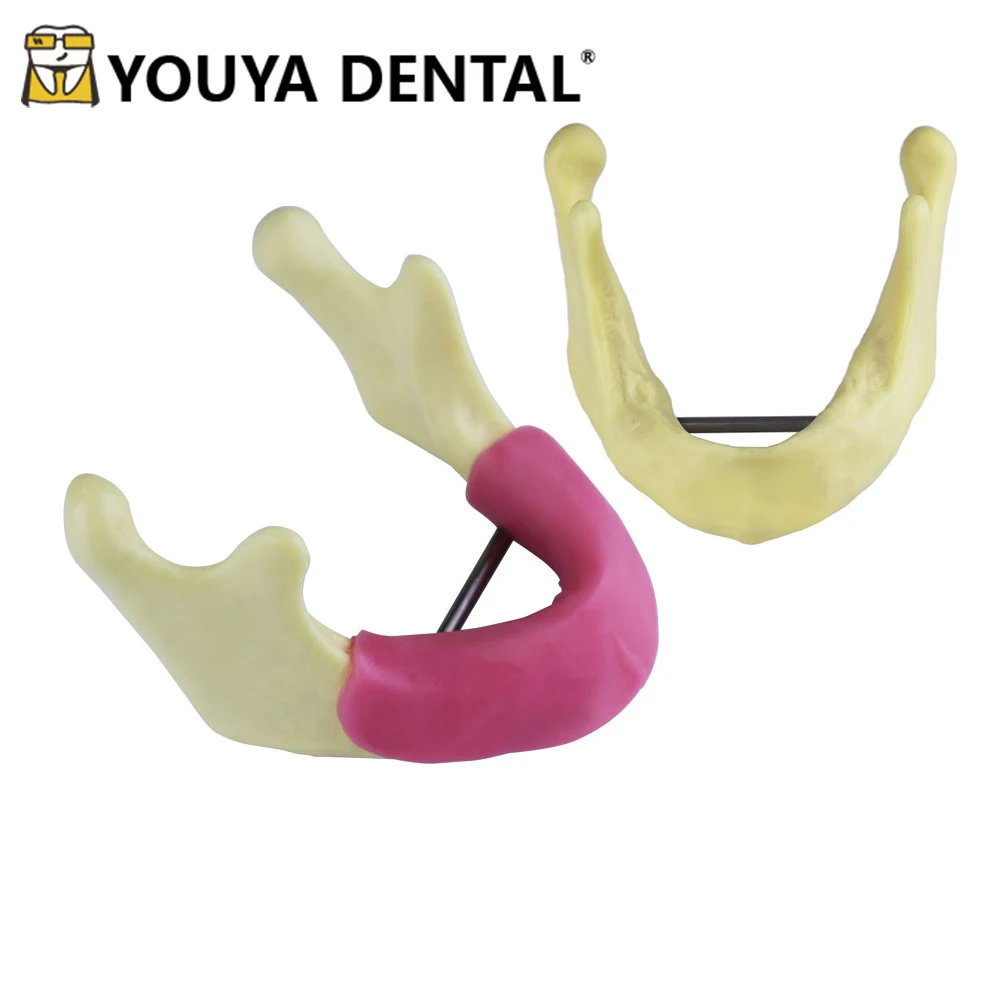 Dental Mandibular Implant Model Implant Practice Model for Dentist Student Teaching Studying Oral Medical Communication Tools