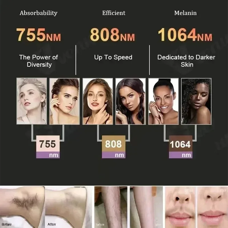 808nm أليساندريت المهنية ديود الجليد التيتانيوم آلة إزالة شعر الجسم بالليزر 3 موجة جهاز دائم CE امرأة 3000 واط
