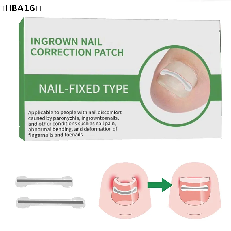 maveraHBA16 Adesivos de Correction d'ongle incarné Patchs correcteur d'ongle Invisible Patch auxiliaire haute résistance Traitement de Paronychia