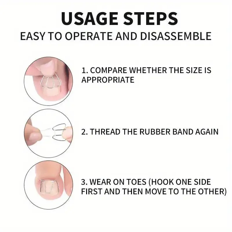 ชุดเครื่องมือแก้ไขเล็บข้อเท้าเกิดจากเล็บงอกขึ้น 6 ชิ้น พร้อมที่รัดเล็บ/ยางรัดสำหรับยืดเล็บ รักษาโรคเล็บข้อเท้าอักเสบ และทำเล็บเท้า