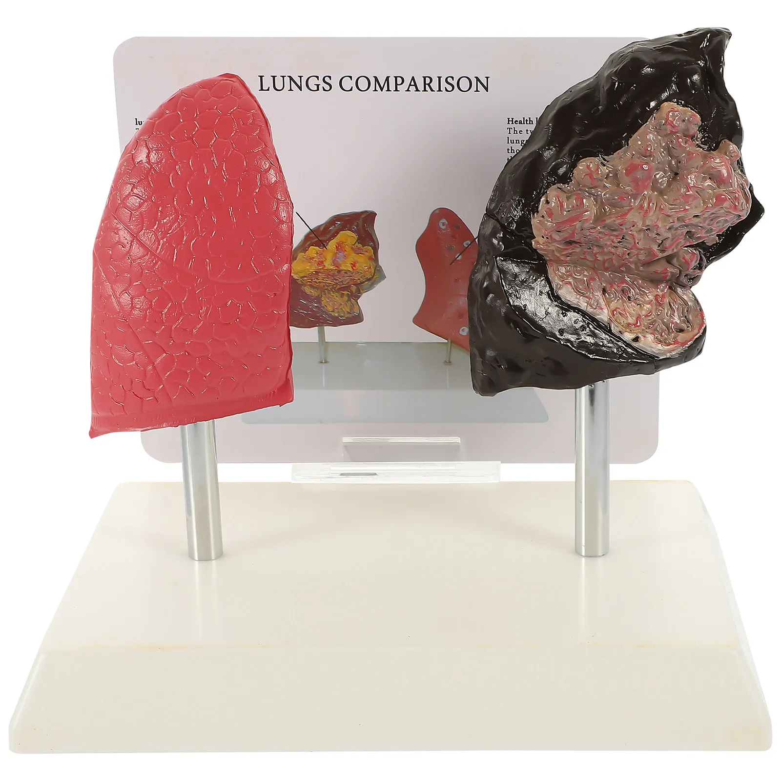 

1Pcs Lung Anatomy Comparison Smoking and Normal Teaching Demonstration Respiratory Pathological Display Educational