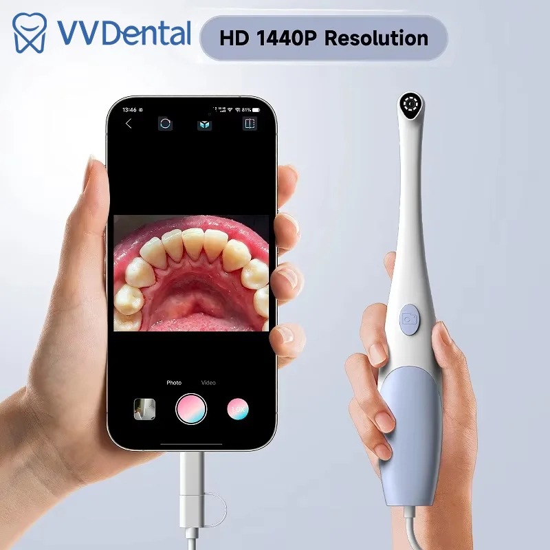 

2 in1 IOS and Type C 1440P Dental Intra Oral Camera Handy Portable Dental Digital USB Endoscope HD Intraoral Camera with 8LED