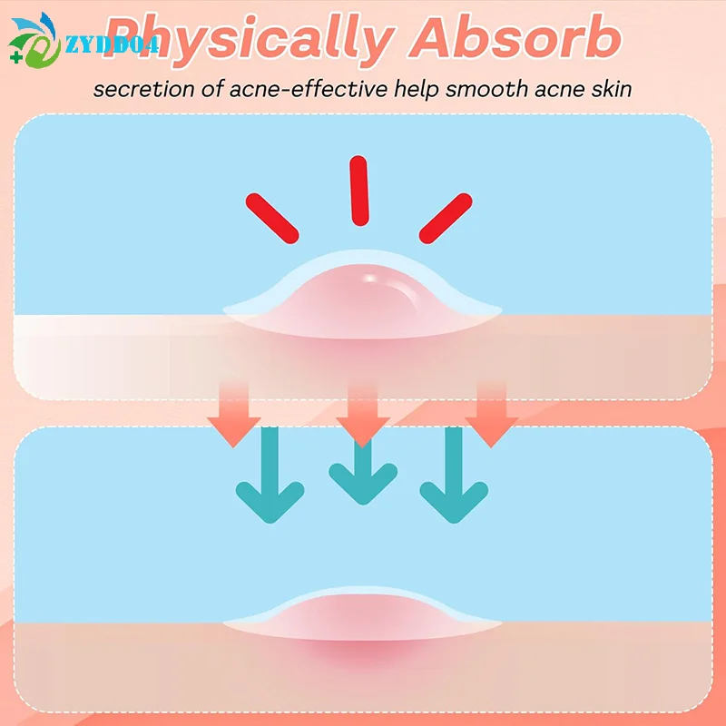 ● 360 pz Bocca Blister Patch Mal di Freddo Labbro Blister Patch Freddo Mal di Guarigione Idrocolloide Cura Delle Labbra Adesivi Bocca Blister Patch