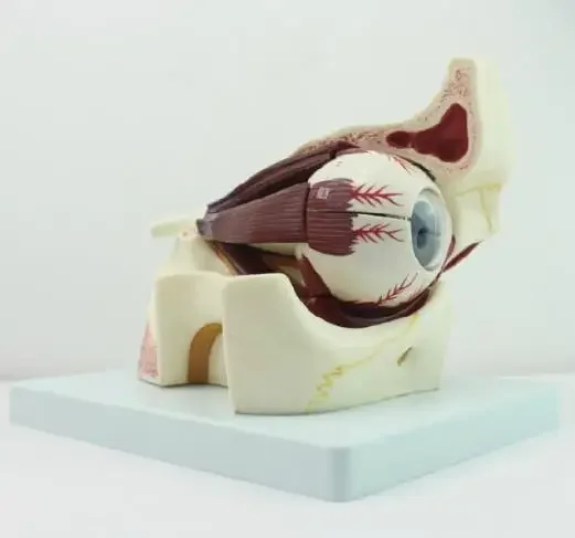 Human eyeball lesion model, pathological glaucoma, cataract anatomical eye lesion model