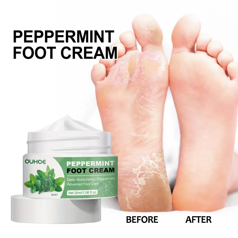 Crema para pies PepperMint, producto para eliminar la piel muerta, tratamiento de reparación de grietas en el talón, crema hidratante para manos y pies, mascarilla exfoliante para el cuidado de la piel