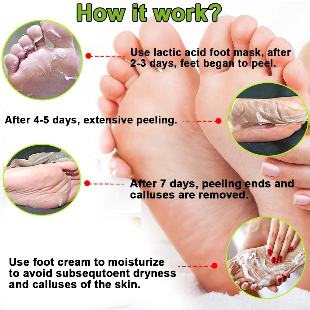 FlowWeek Urea 40% Cracked Heels Foot Cream, Salicylic Acid, Cracked Heels Repair Callus Remover, Nail Repair Urea Cream