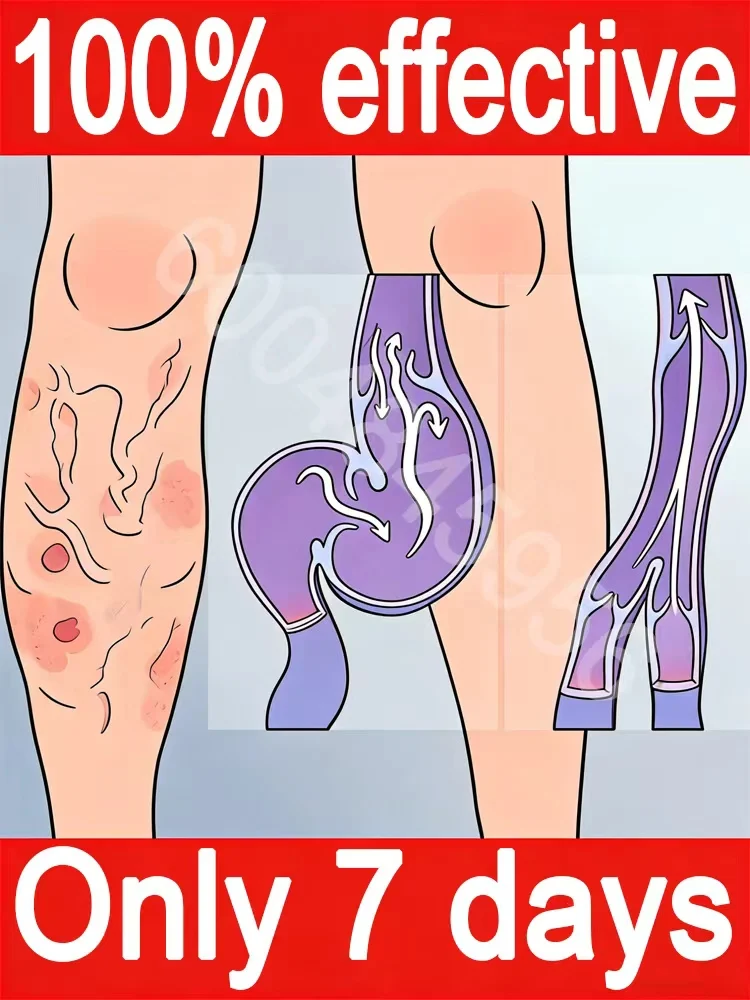 Bᴇsᴛsᴇʟʟɪɴɢ blue laser ᵖᵒⁱⁿᵗᵉʳ ᵏⁱᵗ protects your legs