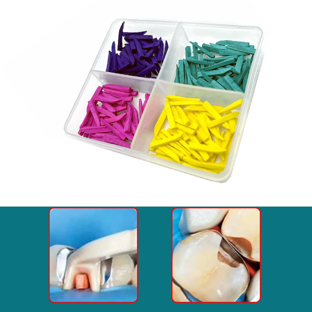 

200Pcs Wood Dental Interdental Wedges Tooth Gap Wedges Specially Treated Tips for Gum Protection 4 Sizes Set