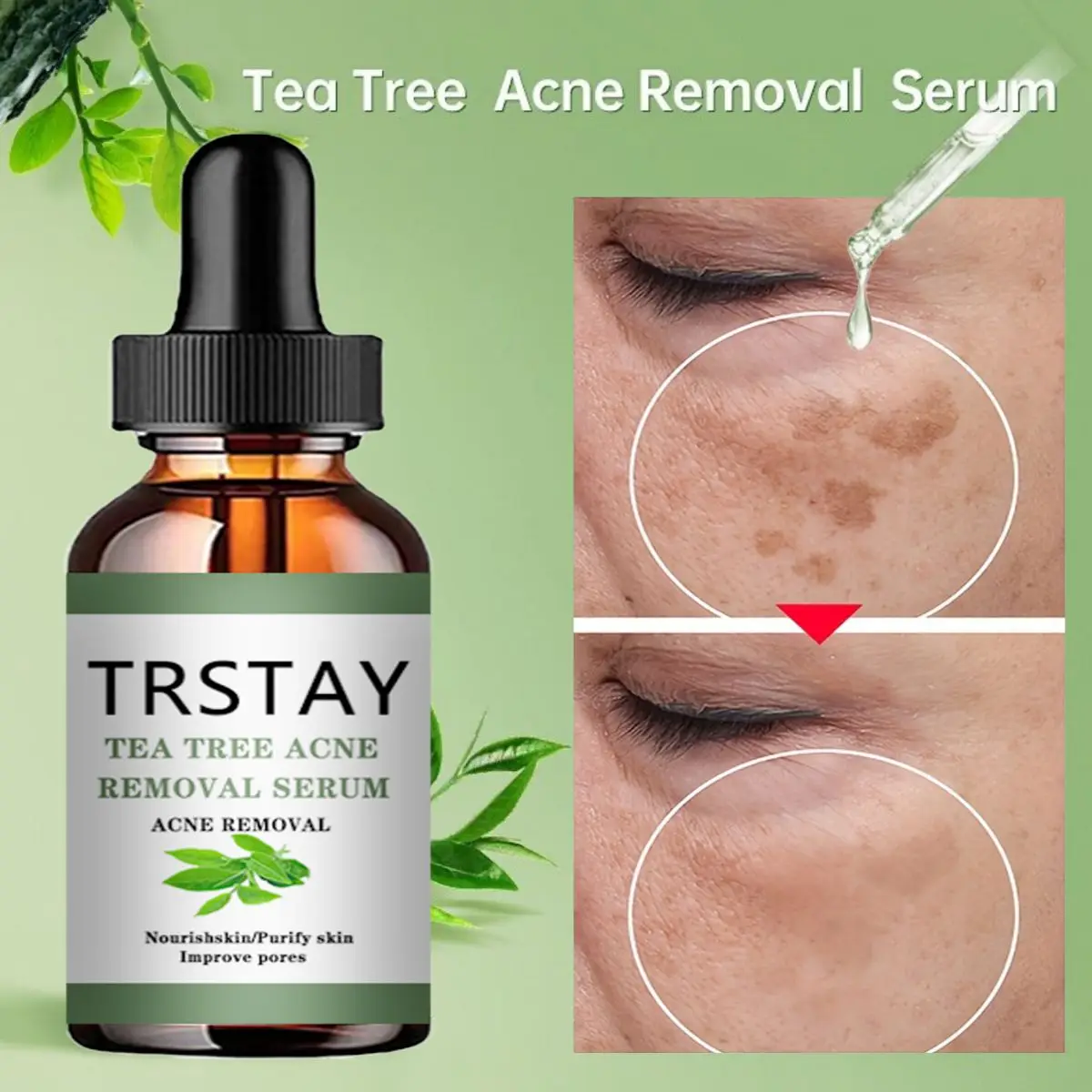 Acne Treatment Face Serum Tea Tree Oil Essence Moisturizing Shrink Pores Acne Facial Serum Korean Skin Care P