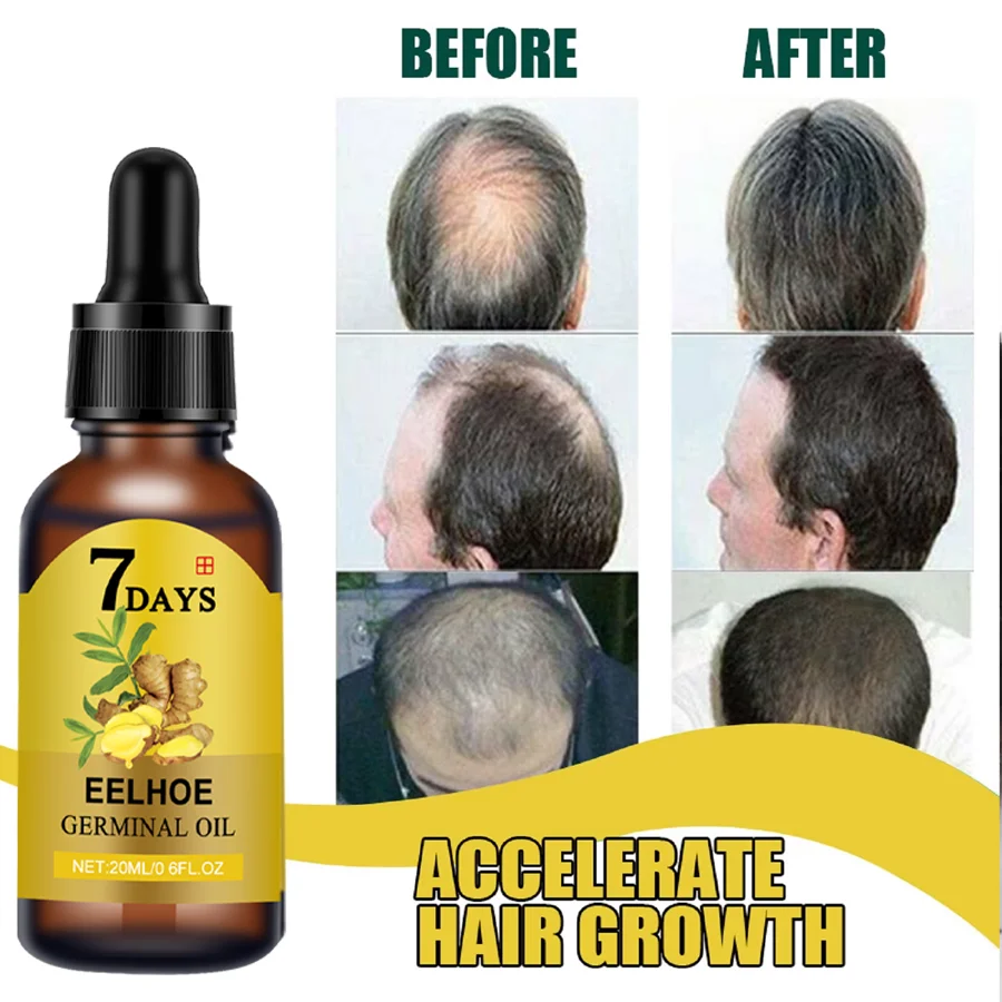 1 Minyak Rambut Jahe dan Serum Rambut Biotin, Pijat Rambut Jahe Bergizi 7 Hari untuk Semua Jenis Rambut, Pelembab, Valentin Sempurna