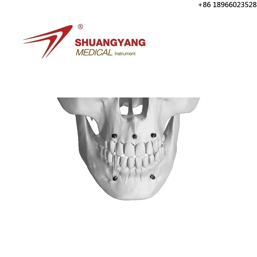 Bone - related ligation nail and instrument