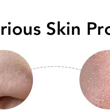 بالموجات فوق الصوتية الجلد الغسيل الكهربائية تنظيف الوجه المسام المطهر العميق حب الشباب مزيل الرؤوس السوداء تقشير مجرفة جهاز تجميل #6