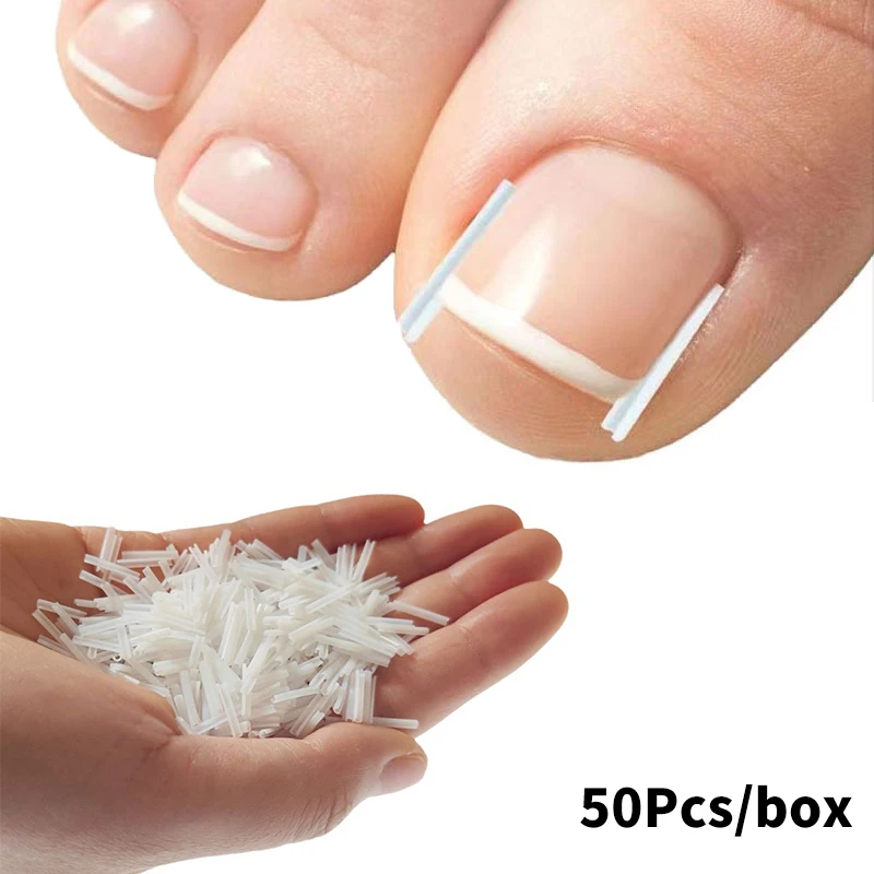 Herramienta de corrección de uñas encarnadas, 50 Uds., tratamiento de uñas encarnadas, parche elástico, pegatina, Clip alisador, herramienta de pedicura