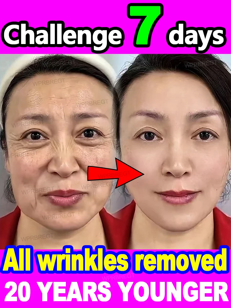 

20 years younger, no fine lines