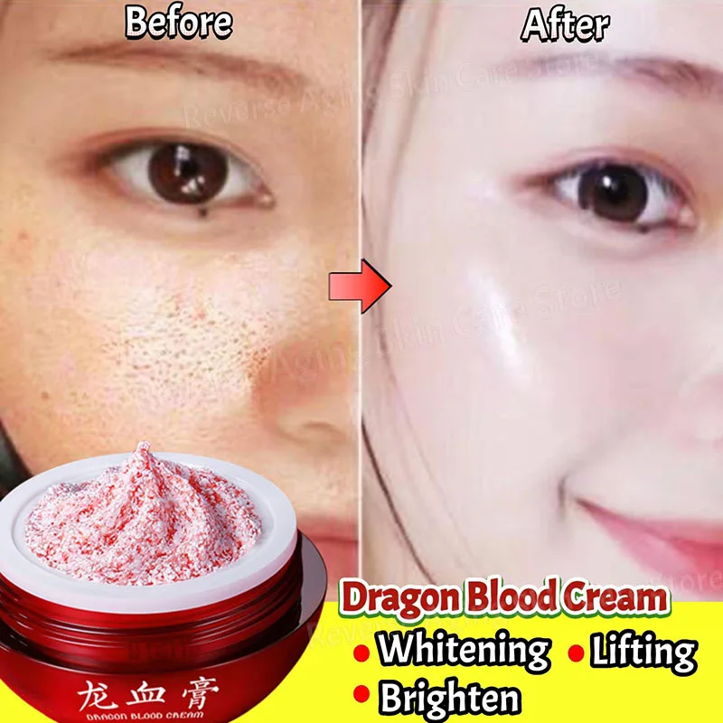 

Effective Whitening Cream Shrink Pore Remove Wrinkle Lift Firming Rejuvenation Anti-aging Moisturizing Dragon's Blood Face Cream