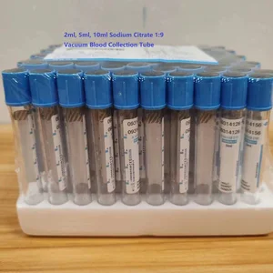 50 قطعة / الكثير سترات الصوديوم 1: 9 أنبوب جامع الدم الأزرق الفراغ القابل للتصرف أنابيب معقمة EN أعلى 12 مبيعات لمعادن الصوديوم - رقم 6