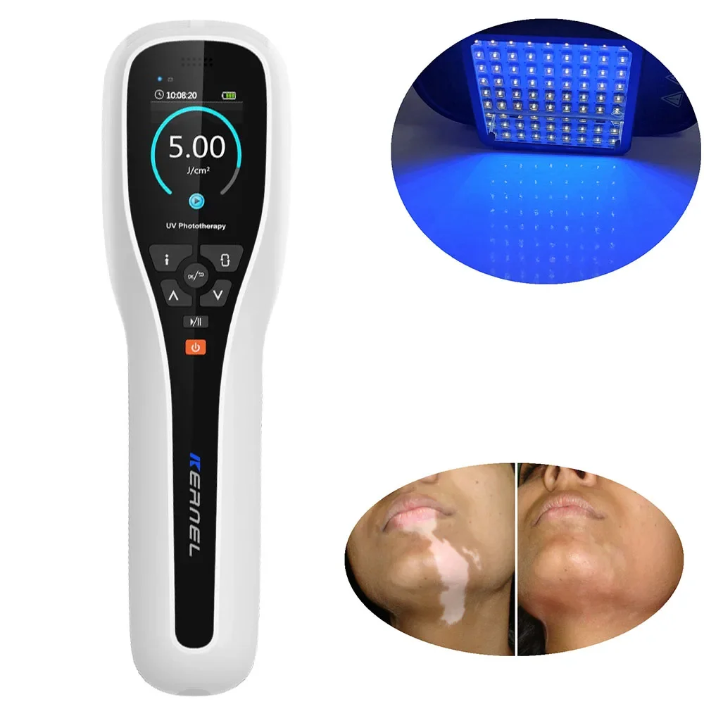 

Physical Therapy LED Excimer KN-5000G Kernel Excimer Laser 308nm Psoriasis Vitiligo Laser Machine