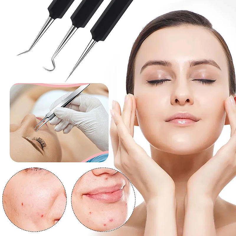 Blackhead Pimple Remover Tool Agulha De Acne De Aço Inoxidável Clipe De Célula Afiada, Tratamento De Limpador De Poros, Face Cuidados Com A Pele, Maquiagem Ferramenta, 1Pc