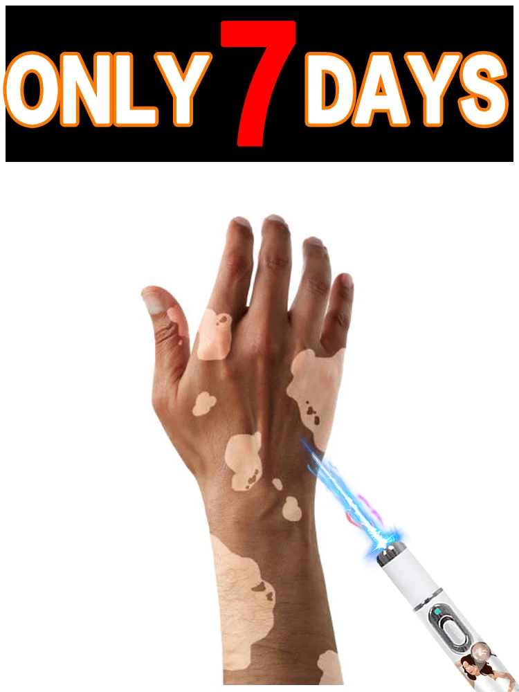 

A new option for vitiligo symptom care! Blue light care tool with blue pen, safe and convenient to meet your needs