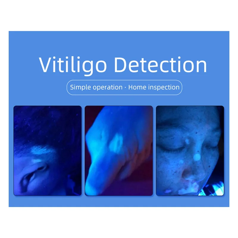 Détecteur de machine de salon à domicile bien fait-Spa Test de beauté Soins du visage Détecteur d'analyse grossissante du visage Détecteur de peau (B)