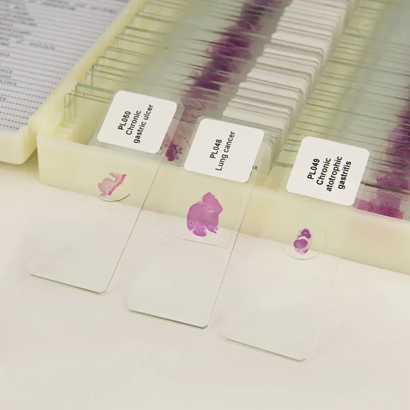100 kinds Medical Pathological Sections of Human Body Typical Prepared Tissue Specimen Slides Microscope Glass Slice HE Staining