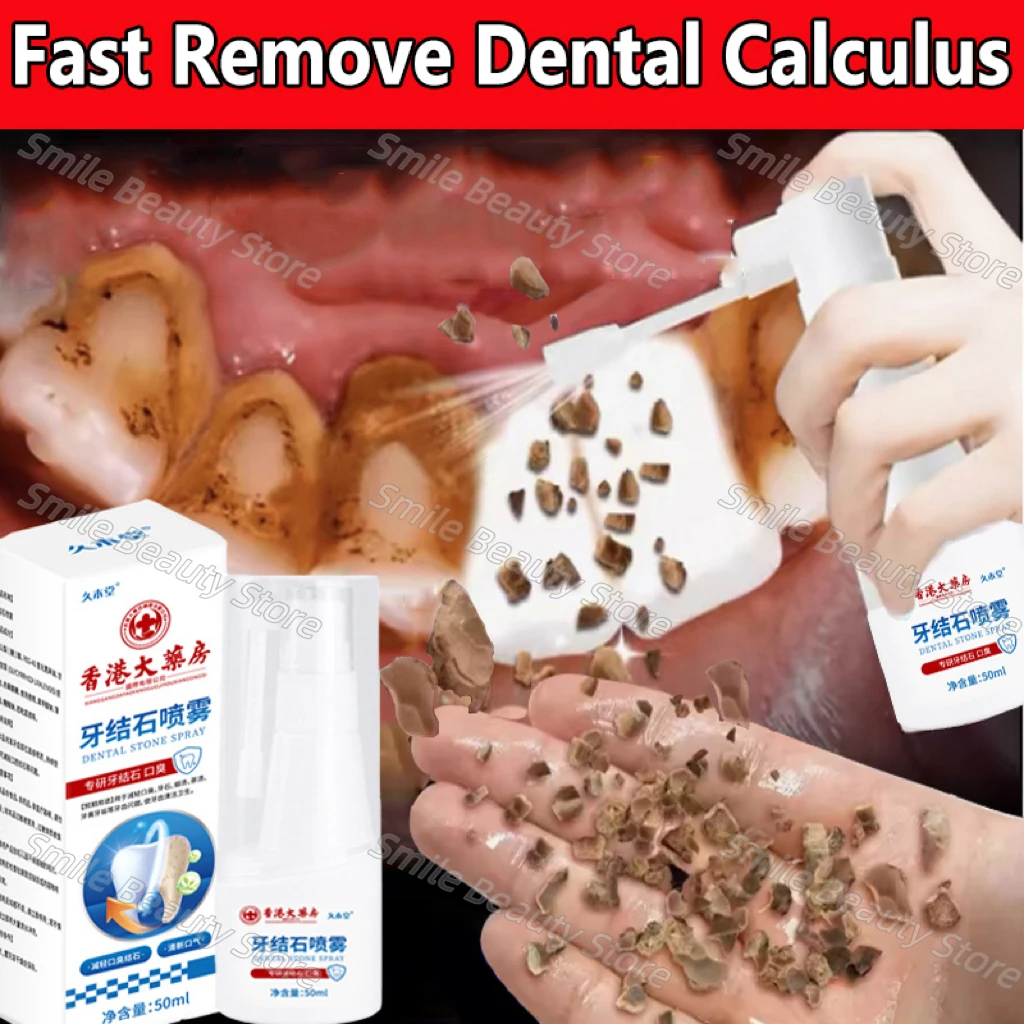 Dental Calculus Remover Teeth Whitening Spray Toothpaste Cleaning Oral Hygiene Removal Halitosis Plaque Stains Fresh Breath Care