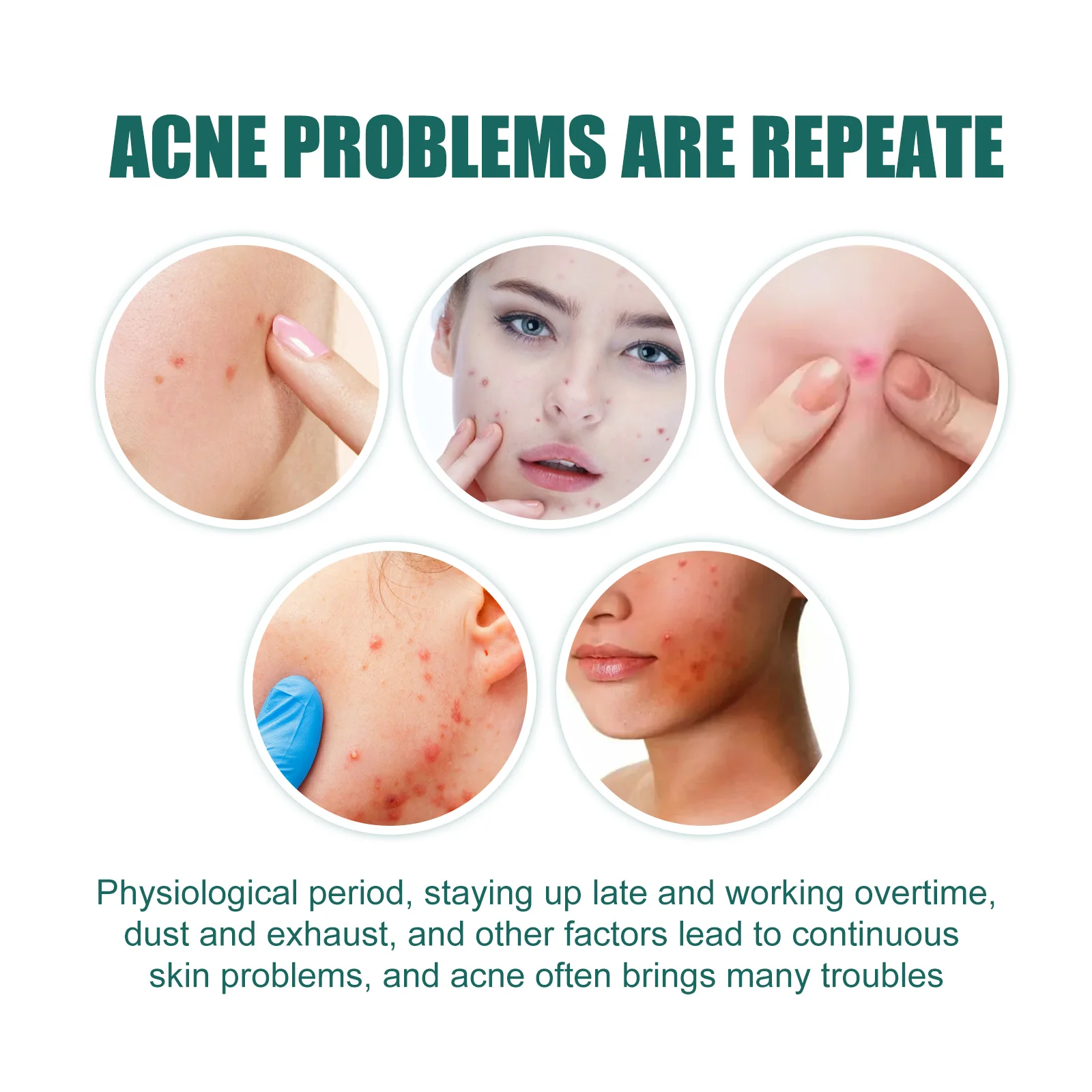 Star-Shaped Acne Pimple Patch - Gentle Cleansing, Acne Fading & Soothing Facial Cleansing Care Patch for Acne-Prone Skin
