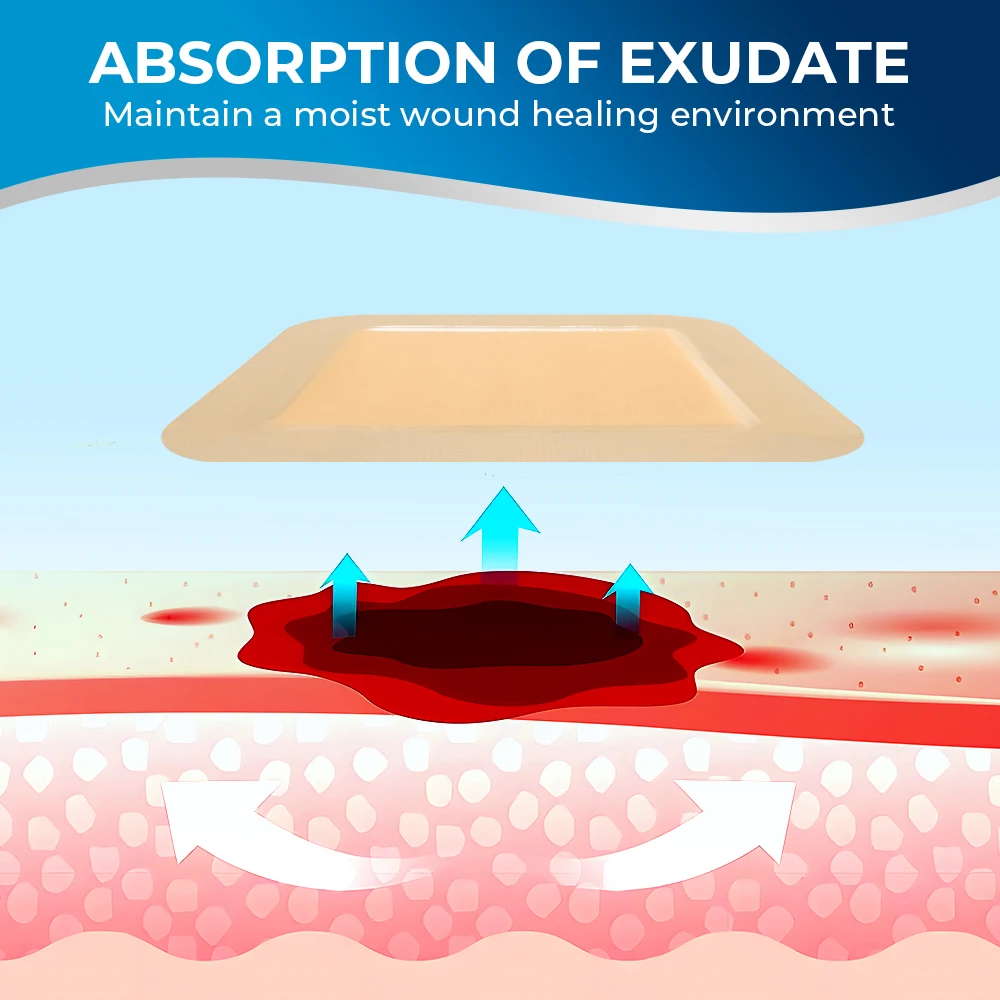 5 قطعة رغوة السيليكون خلع الملابس مقاوم للماء مضاد للجراثيم مكافحة العدوى لينة الجلد ودية Sacrum لاصق خلع الملابس المنزل الإسعافات الأولية #5