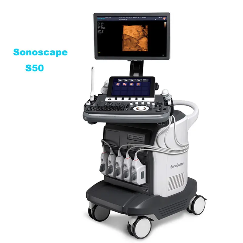 Sonoscape S50 Elite 4D Trolley Medical Ultrasound Equipment Color Doppler Ultrasound Machine