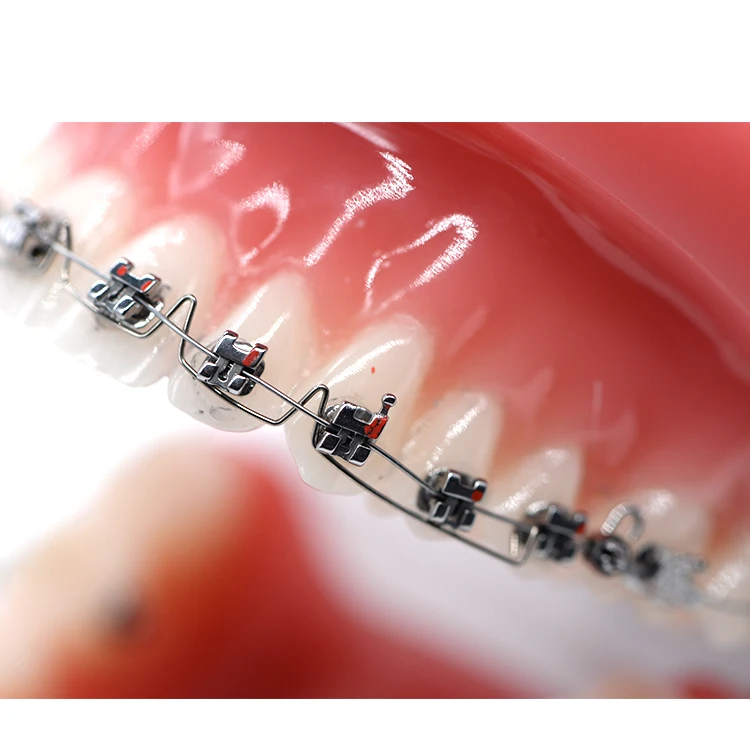 Рисунок 5 - Стоматологические аксессуары для зубных протезов