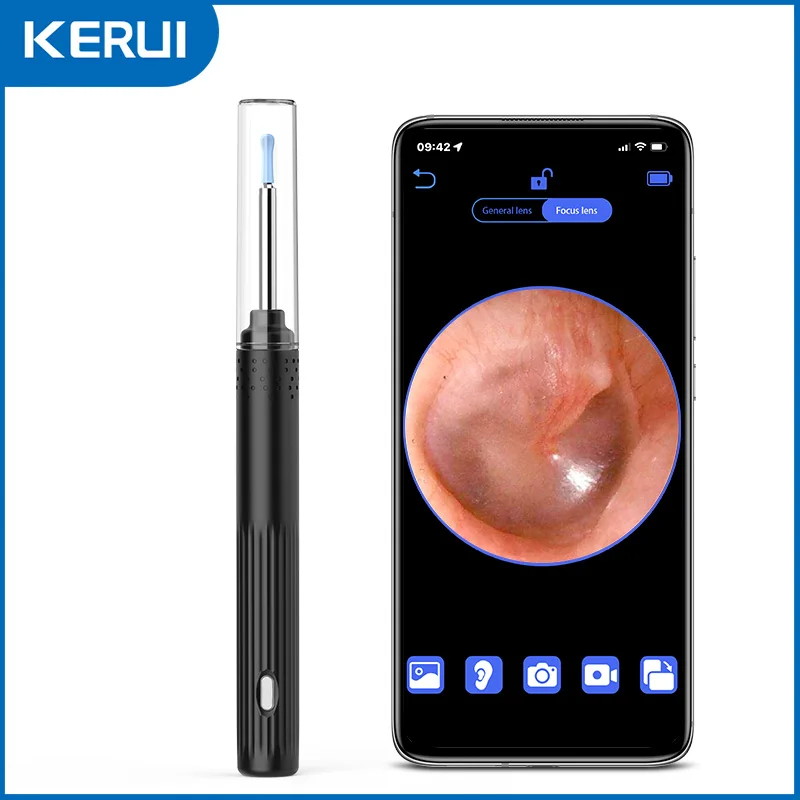 HD Ear Cleaner Camera Otoscope Video In Ear Cleaning Endoscope Spoon Mini Camera Ear Picker Ear Wax Removal Visual Ear Mouth