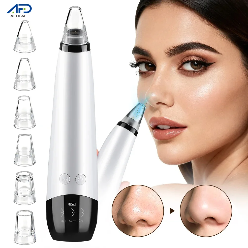 Facial Comedondrukker Elektrisch Heet Kompres Vacuüm Pore Cleaner Gezicht Diepe Neus Cleaner T Zone Porie Acne Puistje Removal Tool