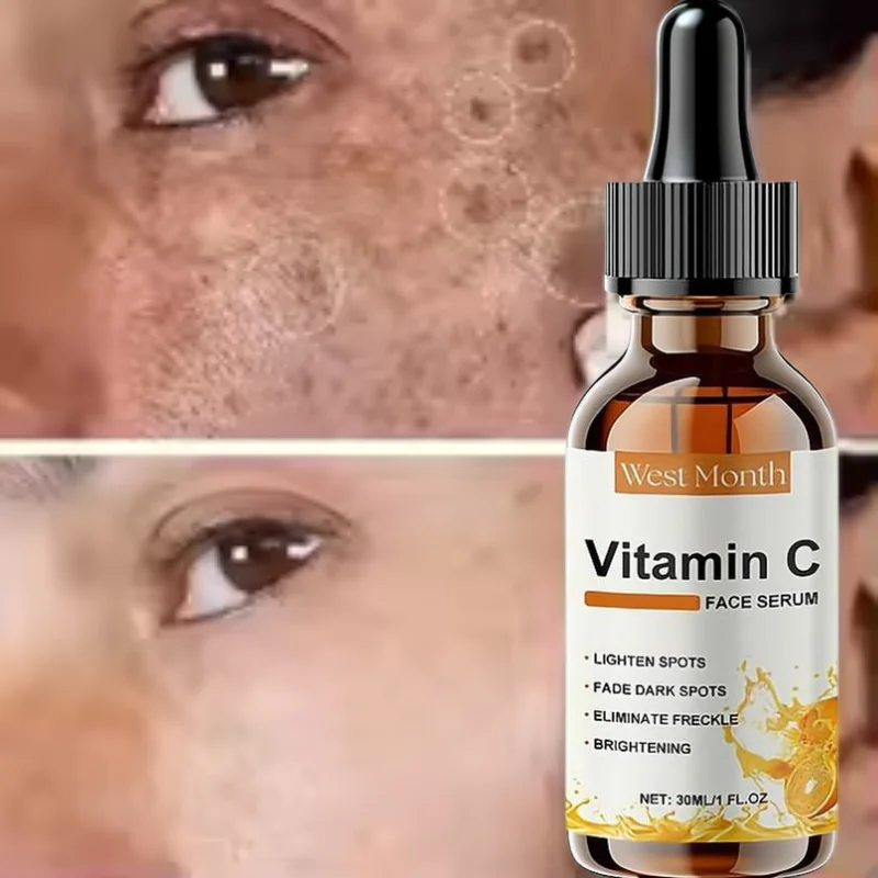 30ml VitaminC Skin Brightening Serum Contains Hyaluronic Dark Spot Corrector Brightening Face Serum for Freckle Removal SkinCare