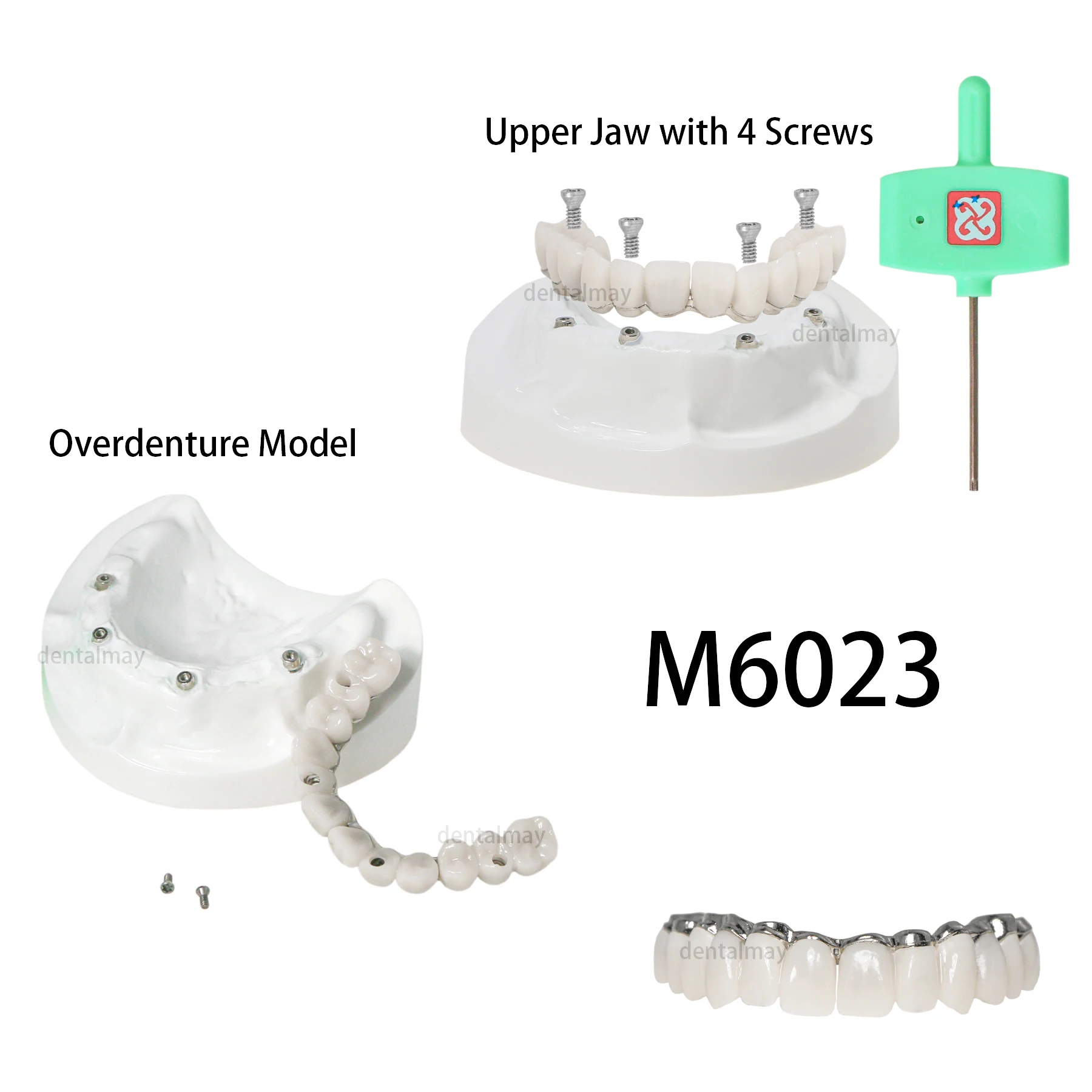 

Dental Teeth Model All-on-4 Overdenture Model Upper Jaw Implant Restoration with 4 Screws M6023