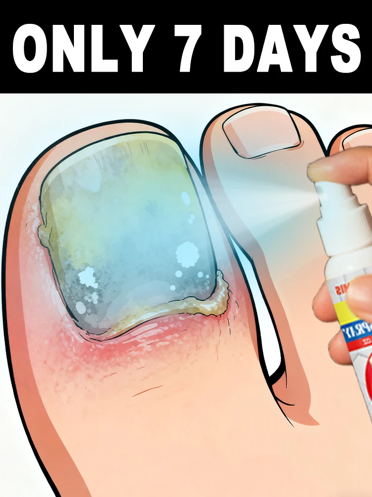 

It doesn't sting after application ᵃⁿᵈ ᶜᵃⁿ ᵉᵛᵉⁿ ᵖʳᵒᵐᵒᵗᵉ ⁿᵉʷ ⁿᵃⁱˡ ᵍʳᵒʷᵗʰ‧