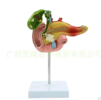 

Life Size Anatomical Human Pancreas Duodenum Gallbladder Pathology Model, Lab Office Equipment School Students Supplies