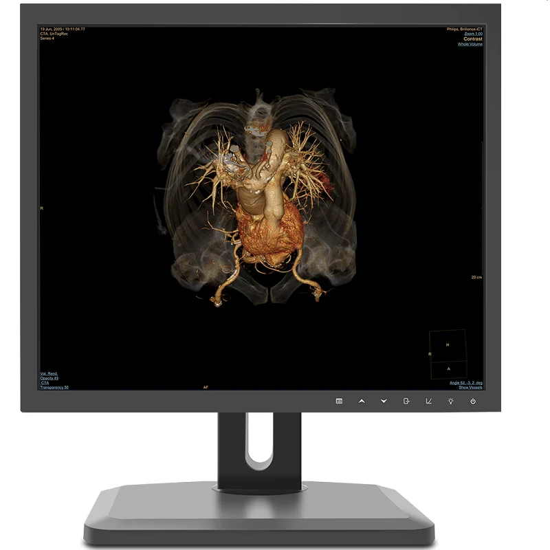 Radiology, endoscope, ultrasound system display Medical LCD screen Ultrasound image display