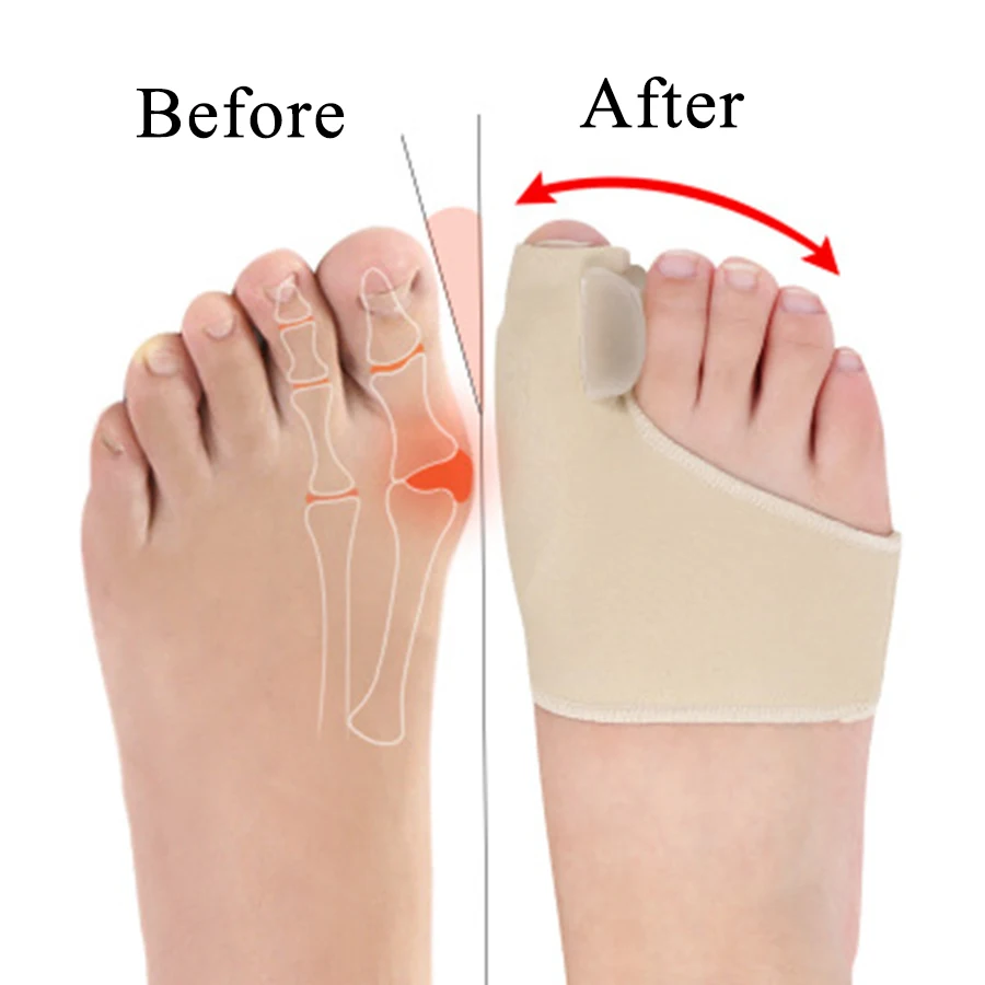 New Bunion Straighteners and Toe Separators Foot Pain Relief For Men And Women