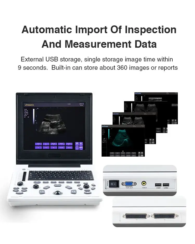 New 12 Inch LED Laptop Portable Notebook Sonography USG Ultrasound Scanner Diagnostic Machine