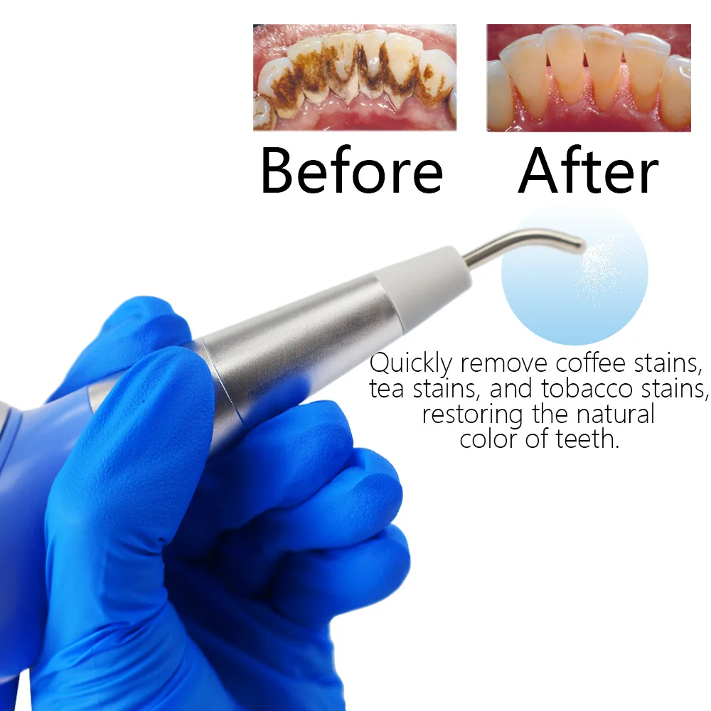 Dental Prophy Jet Air Polishing Unit System 360º Rotation Detachable Spray Polish 2holes/4holes dentistry equipment