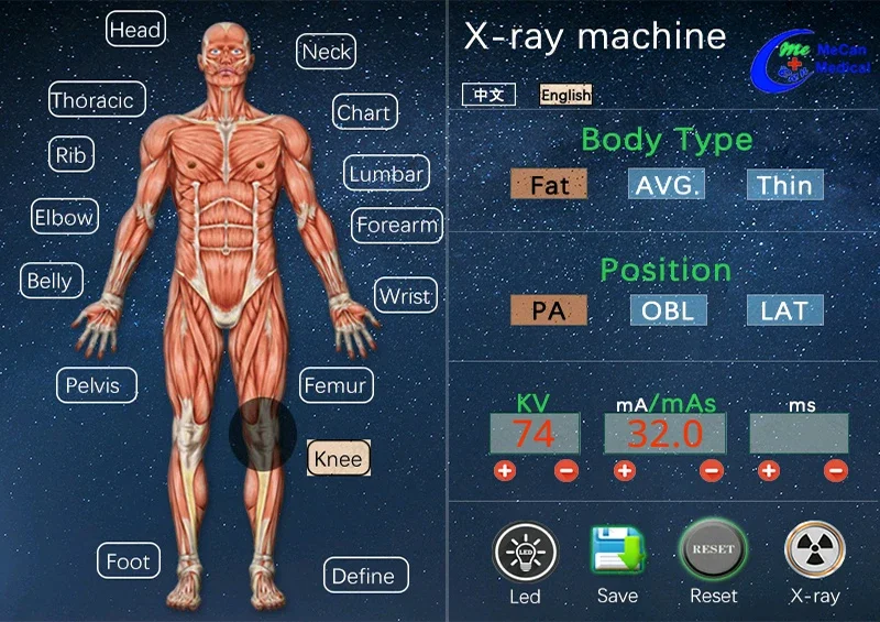 MeCan Medical High Frequency Digital X-ray X-ray Machine 32kw 400mA X-ray Machine Price