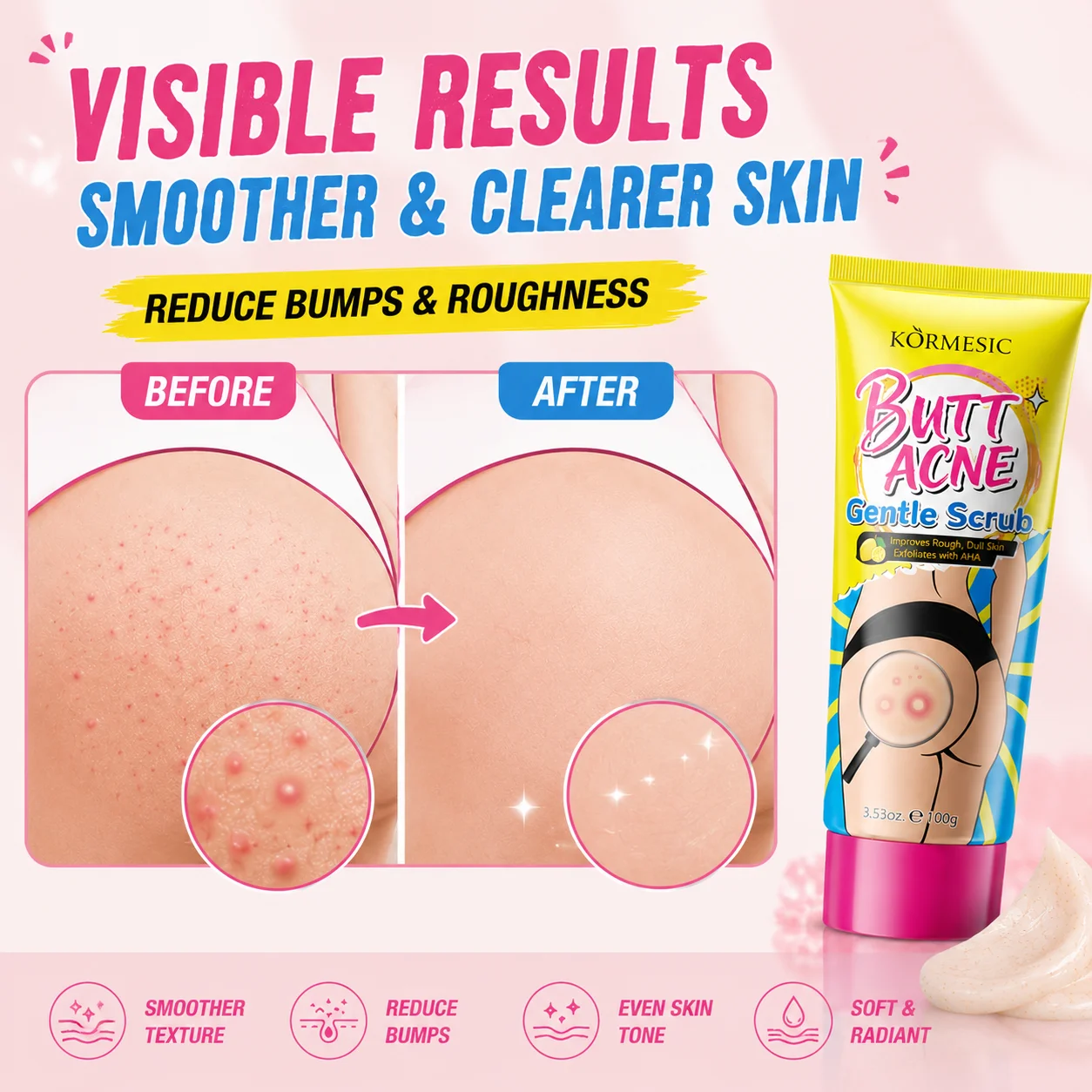 Butt Acne Body Scrub AHA Exfoliating Cream 100g Rough Bumpy Skin Care KP Strawberry Legs Back Acne Gentle Body Scrub Men Women